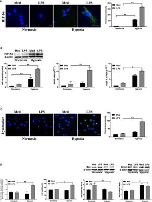 Hypoxia Shapes Autophagy in LPS-Activated Dendritic Cells